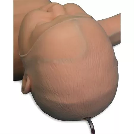 Nita Newborn Replacement Skin & Vein Set