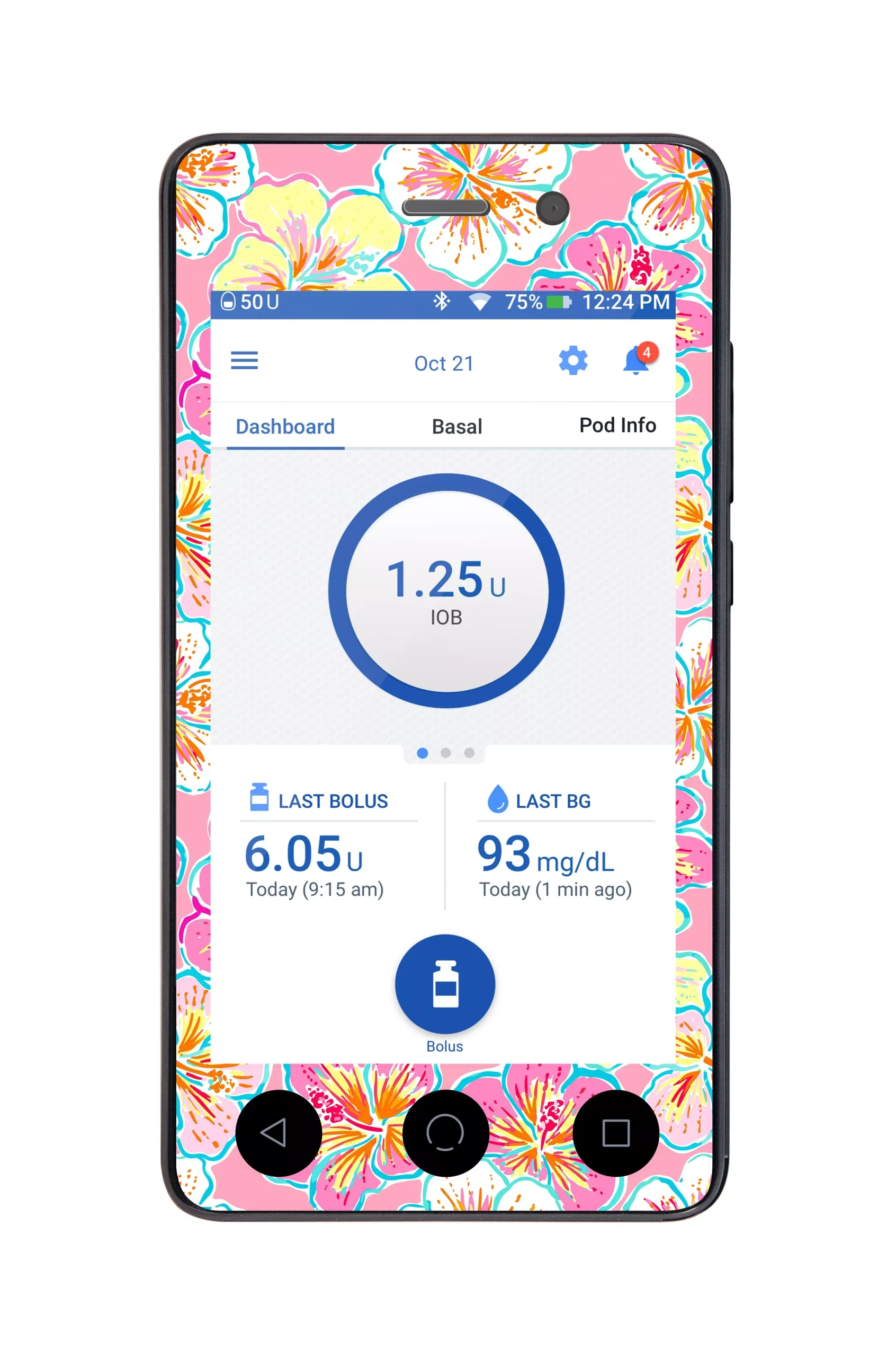 Tropic Crush Sticker for Omnipod DASH PDM – Pump Peelz