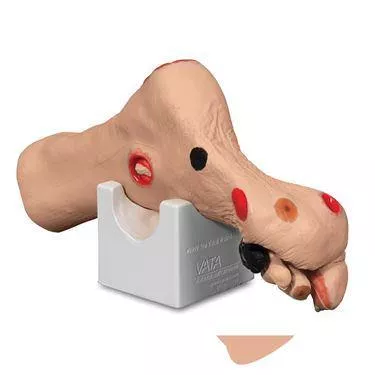 Wilma Wound Foot Wilma Wound Foot ,1 Each